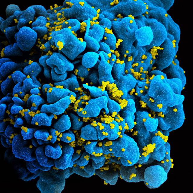 HIV-infizierte T-Zelle