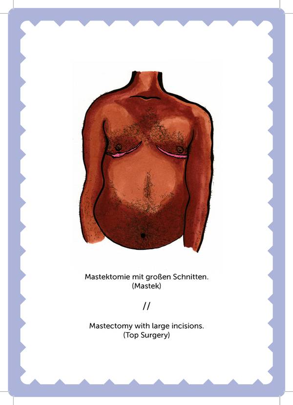 mastektomie-trans-non-binary-LGBTI-magazine-health-gesundheit.jpg